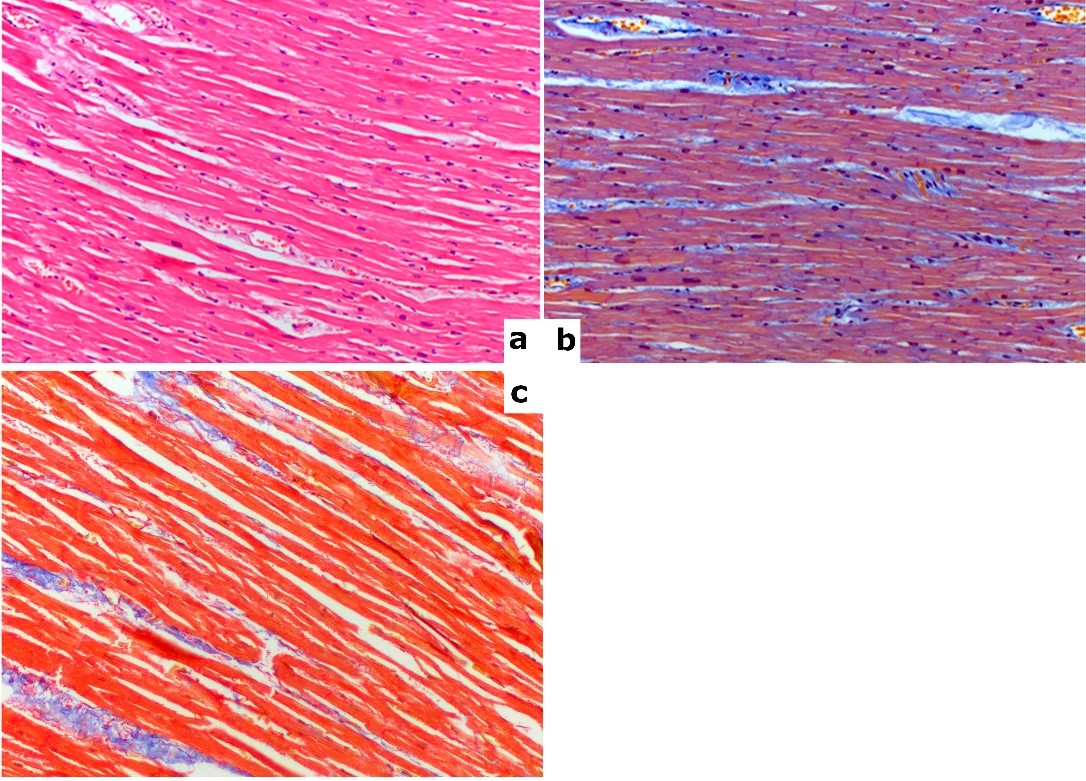 Microphotographs (x200) of the left ventricular myocardium stained with hematoxylin and eosin (a), MSB (b), and Masson’s trichrome (c); collagen fibers are stained blue (b, c).