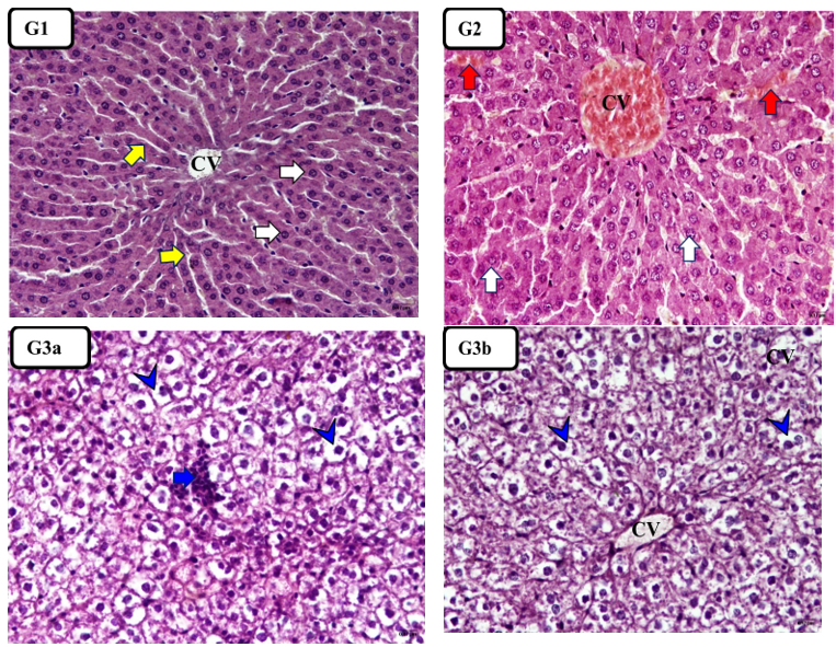 Histopathology of liver tissue from control (G1), khat extract (G2), and PO+YE (G3a,b). PAS stain [100x -400x, scale bar=50 μm]