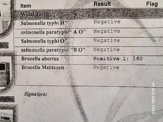 . Positive test for Brucella abortus