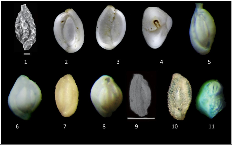 1- Quinqueloculina rariformis, Lateral view, 100μm, 2- Quinqueloculina seminulum, Lateral view, 1020μm, 3- Q. seminulum, Lateral view, 1020μm, 4- Q. seminulum, Apertural view, 1020μm, 5- Quinqueloeulina sulcata, Lateral view,140X, 6- Quinqueloculina trigonula, Lateral view, 140X, 7- Quinqueloculina tropicalis a, Apertural view, 100μm, 8- Quinqueloculina tubus, Lateral view, 140X, 9- Quinqueloculina undulosecostata, Lateral view, 200μm, 10- Quinqueloculina variolata, Lateral view, 140X, 11- Q. variolata, Apertural view, 140X.